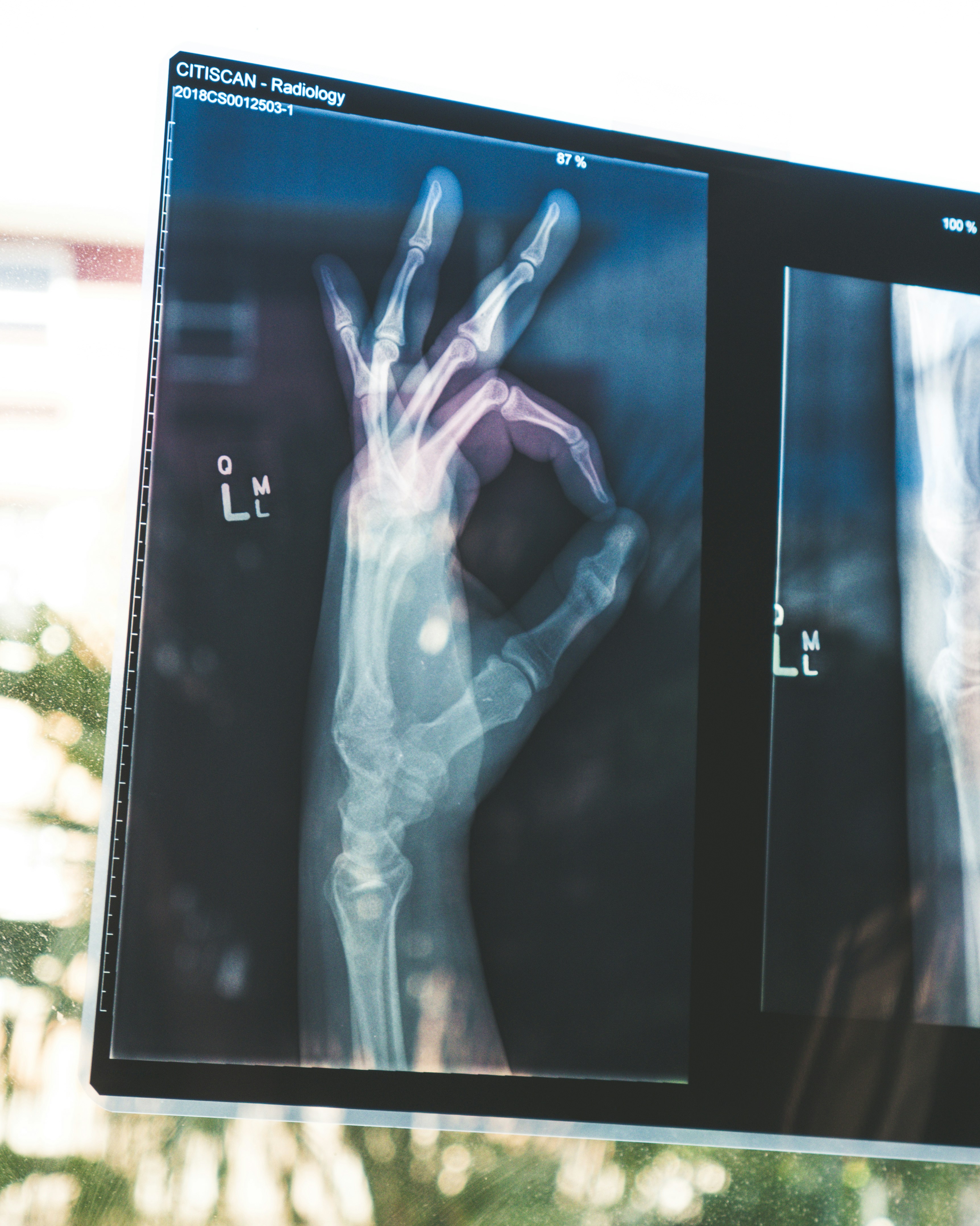 CT scan result illustrating occupational health expertise